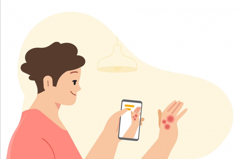 谷歌发布用于识别皮肤状况的健康工具